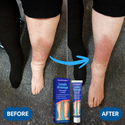 PureCirculin™ natural leg cream