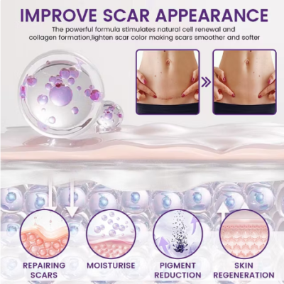 Timilk® ReGenScar Scar Gel with centella asiatica and aloe