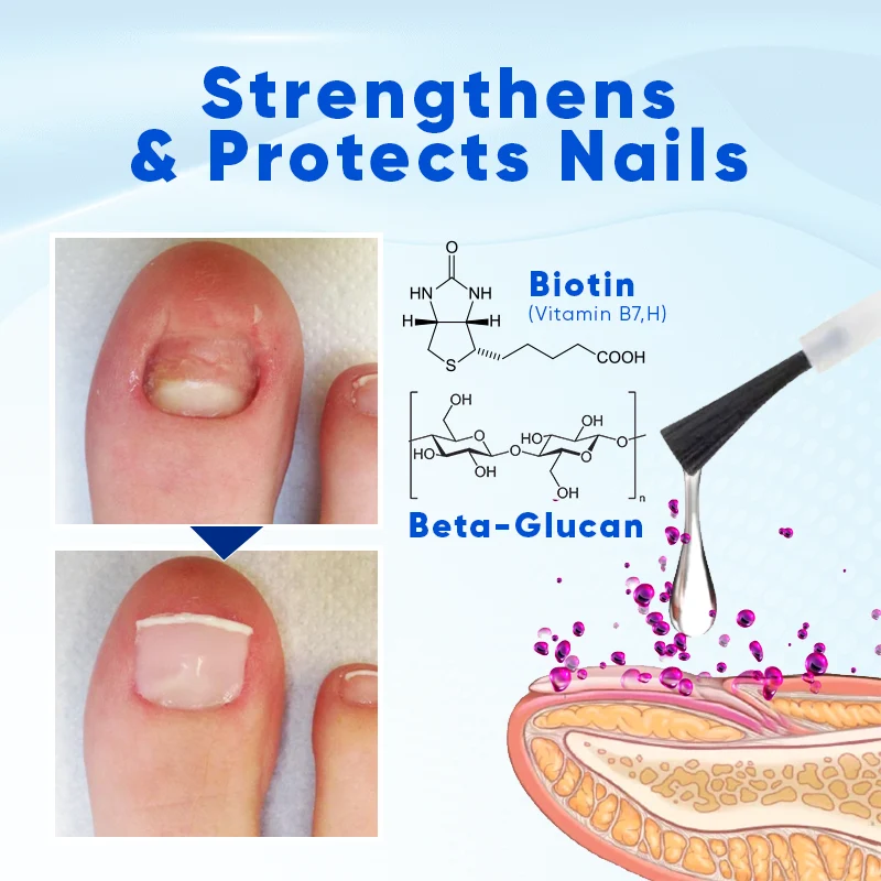 Biancat® OnyxoGuard Nail Repair Serum